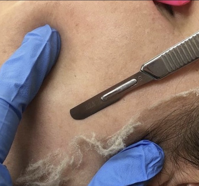 Touch Of Beauty By Melissa